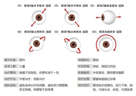 馬竇氏鏡|[問題] 雙眼眼球震顫+內斜(眼位不正)